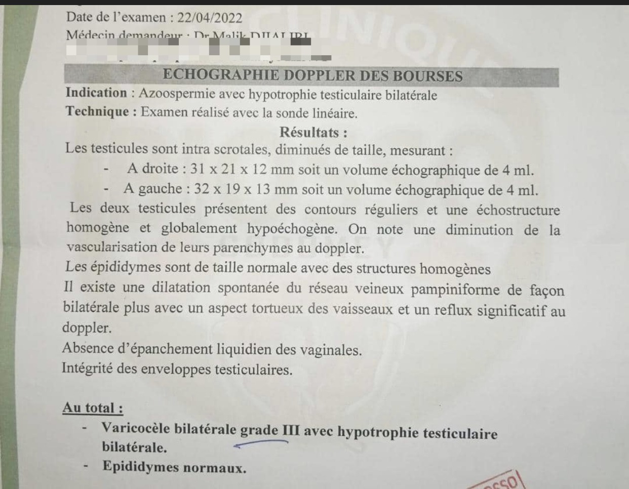 R Sultat Apr S Traitement Varicoc Le Traitement Naturel En Usa