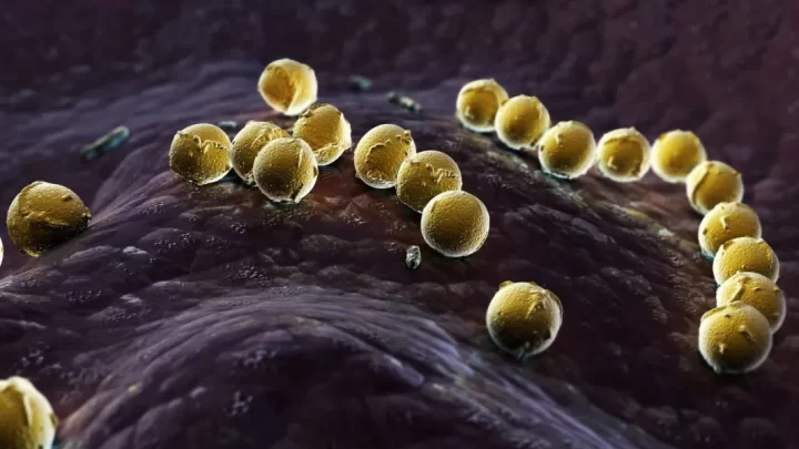 soigner l'érysipèle Solution naturelle