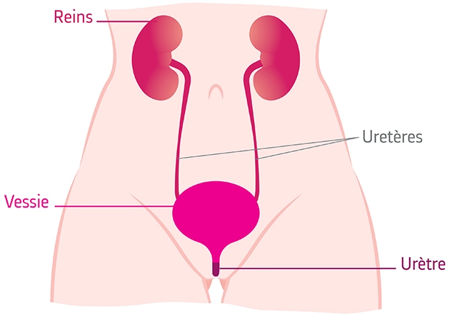 Soigner Infection urinaire naturellement