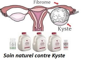 Soin naturel contre Kyste
