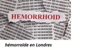 Hémorroïdes Traitement Naturel Hémorroïdes