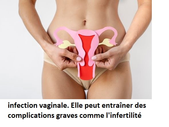 Infections Vaginales et les Trompes Bouchées