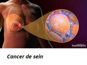03 jours pour traiter le cancer de sein