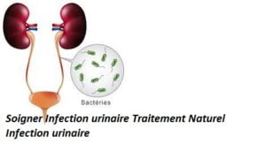 Soigner les infections urinaires naturellement