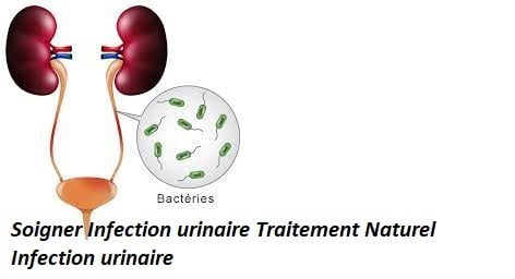 Soigner les infections urinaires naturellement
