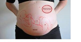 Solution Naturelle pour Faciliter la Conception