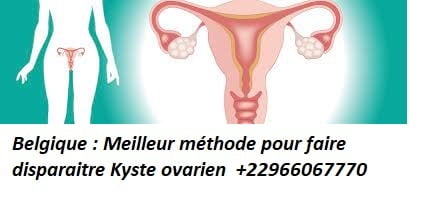Solution soigner Kyste ovarien