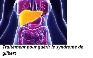 Traitement pour guérir le syndrome de gilbert