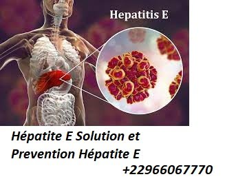 Hépatite E Solution et Prevention Hépatite E