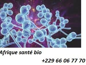 Êtes-vous infesté de Candida Albicans ?