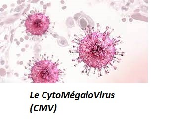 L'infection à cytomégalovirus