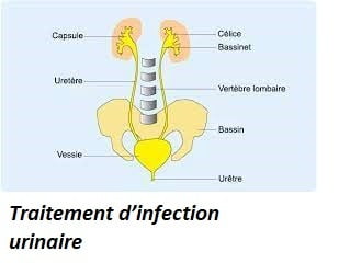 Traitement d’infection urinaire