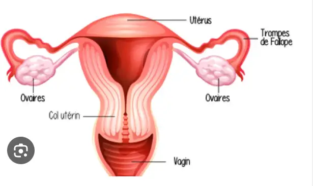 Obstruction tubaire distale gauche