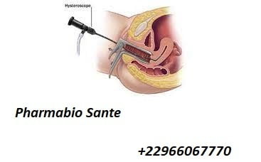 Synéchie Utérine Traiter Naturellement