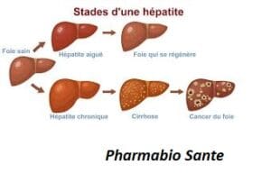 remède naturel contre l’hépatite B