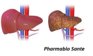 Traitement naturel hépatite B Pharmabio-santé