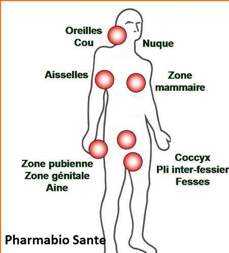 Maladie de Verneuil Traitement Naturel