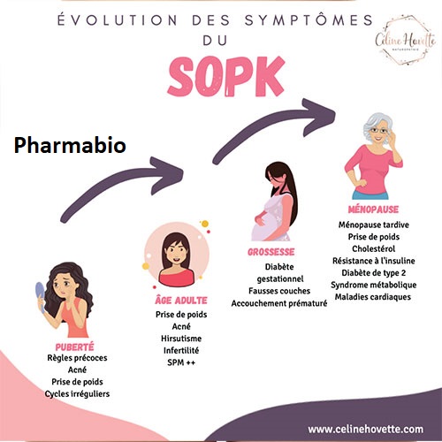 Comment soigner Syndrome des ovaires polykystiques