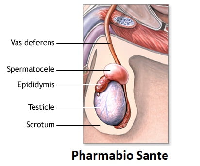 7 Traitements Naturels Spermatocèle