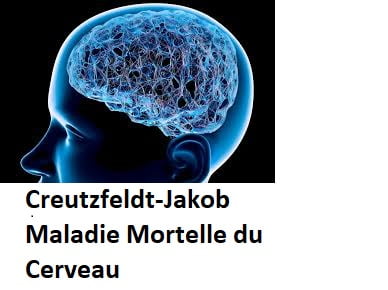 Creutzfeldt-Jakob Maladie Mortelle du Cerveau