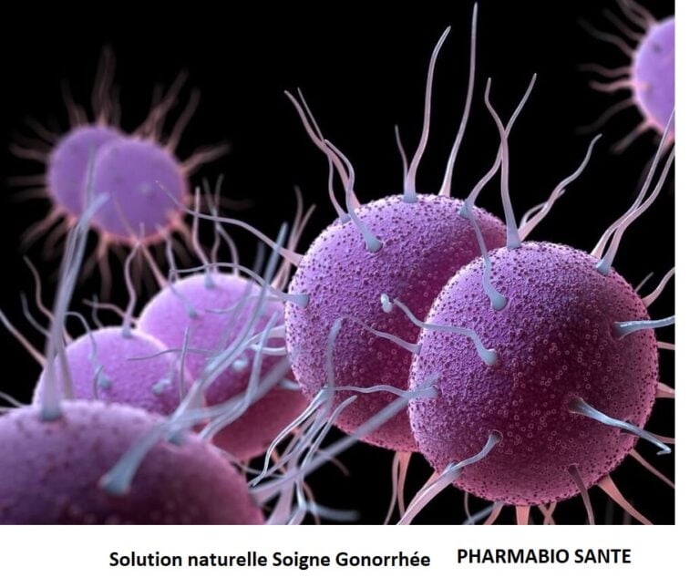 Solution naturelle Soigne Gonorrhée