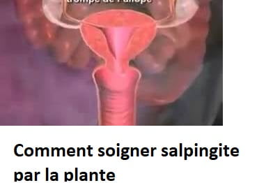 Comment soigner salpingite par la plante