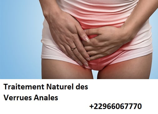 Soigner les Verrues Blanches