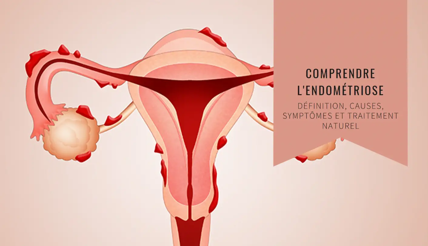 Endométriose Traitement Naturel