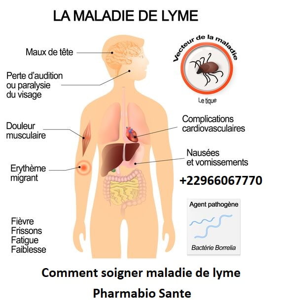 Comment soigner maladie de lyme