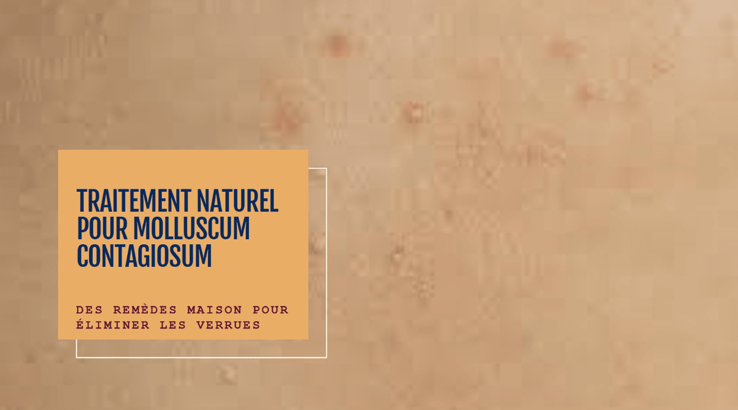 Molluscum Contagiosum Traiter Naturellement