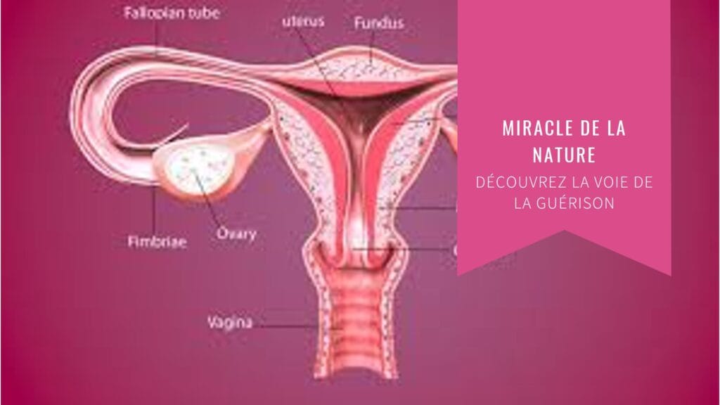 Obstruction des Trompes de Fallope et Infertilité