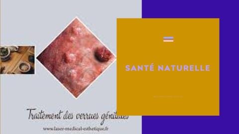 Condylomes Traitement Par Les Plantes
