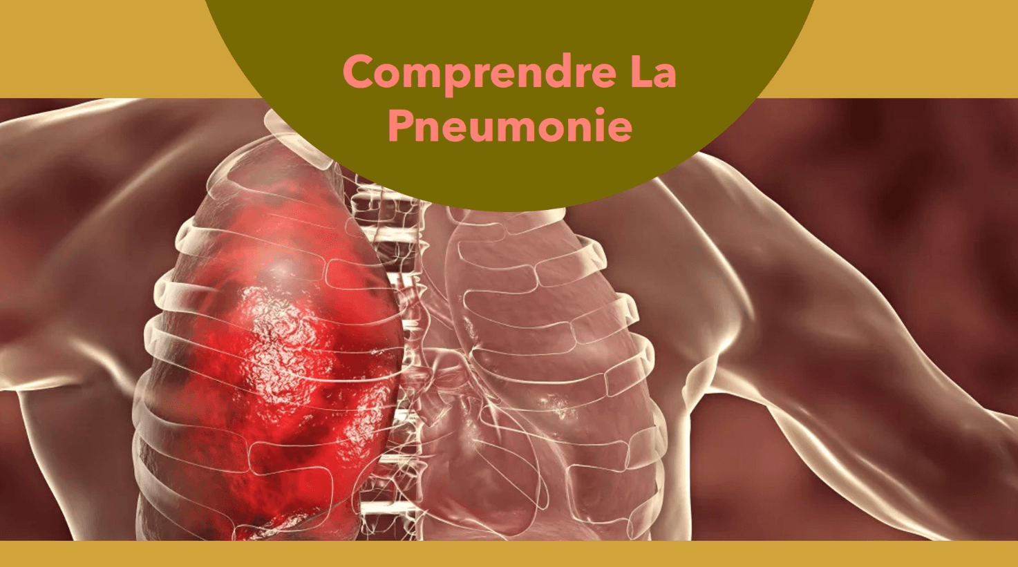 La pneumonie définition