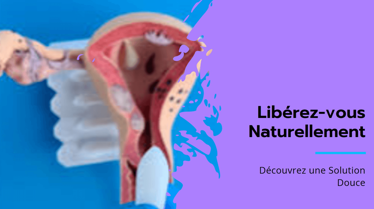 Mycose Vaginale Solution Naturelle