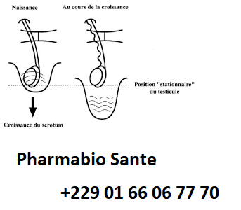 Traiter Naturellement Cryptorchidie