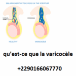 phytothérapie fertilité homme