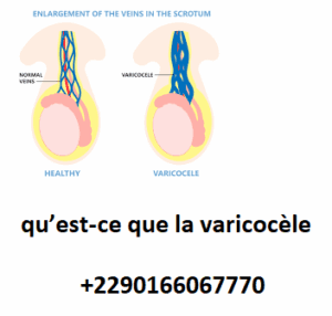phytothérapie fertilité homme