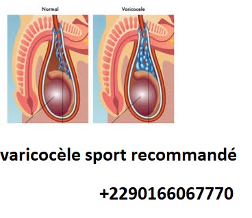 varicocèle sport recommandé