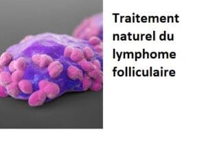 Traitement naturel du lymphome folliculaire