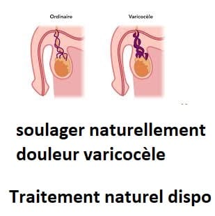 soulager naturellement douleur varicocèle