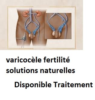 varicocèle fertilité solutions naturelles
