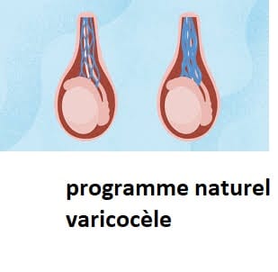 programme naturel varicocèle