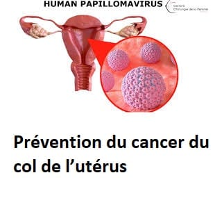 Prévention du cancer du col de l’utérus