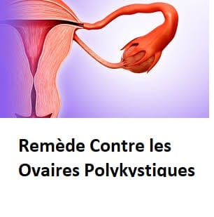 Remède Contre les Ovaires Polykystiques