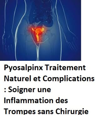 Pyosalpinx Traitement Naturel