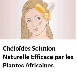 Chéloïdes Solution Naturelle