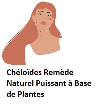 Chéloïdes Remède Naturel Puissant à Base de Plantes
