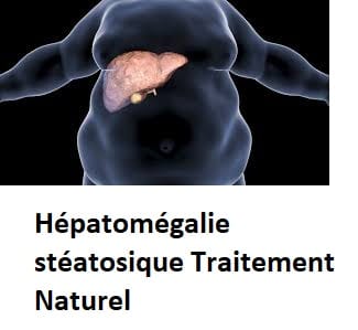 Hépatomégalie stéatosique Traitement Naturel