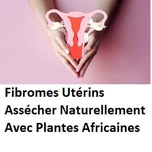Fibromes Utérins Assécher Naturellement Avec Plantes Africaines