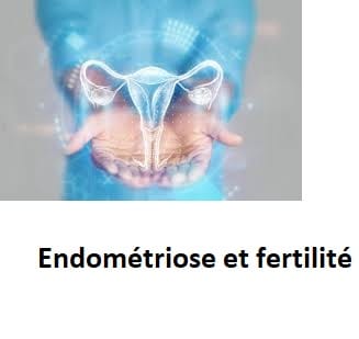 Endométriose et fertilité